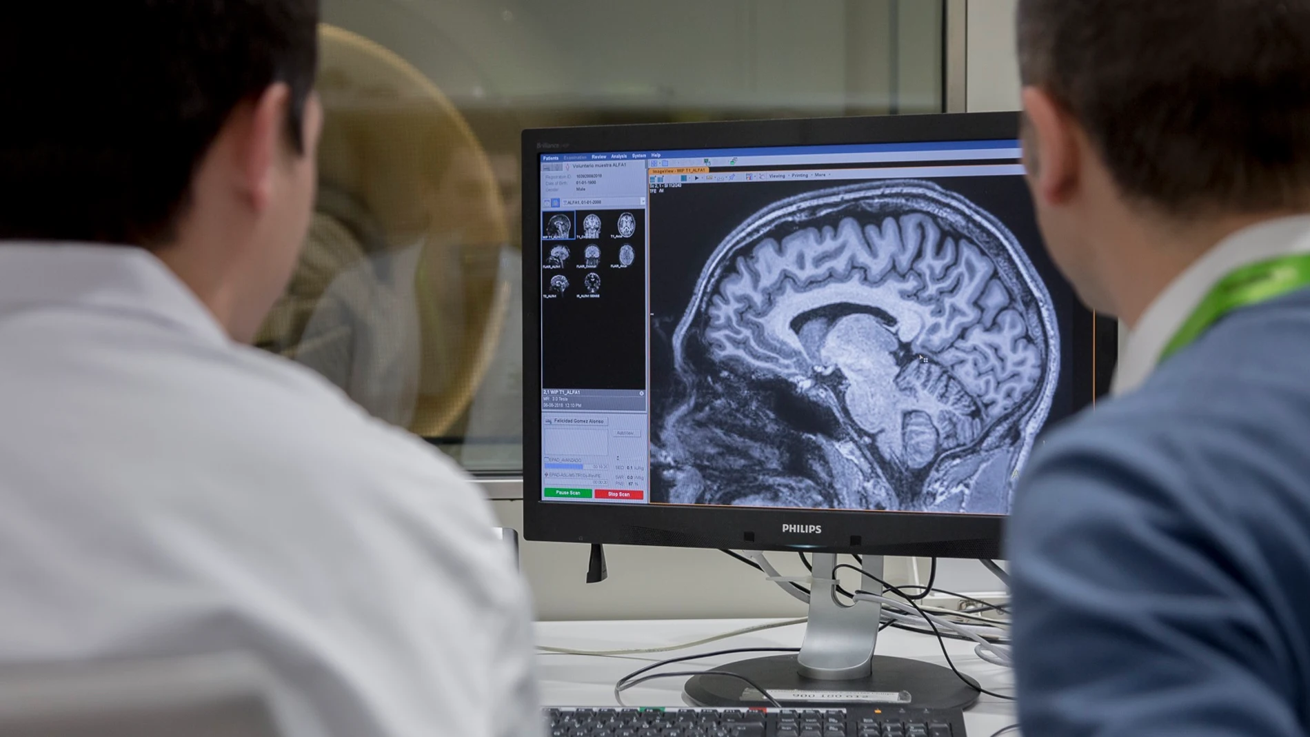 Científicos buscan cambiar el futuro del Alzheimer.webp